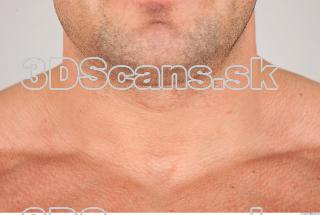 Neck texture of Gene 0002